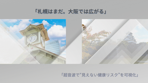 超音波による健康観察で企業リスクが下がる3つの理由