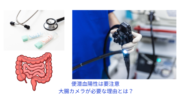 便潜血陽性は“大腸がんの早期サイン”？大腸カメラを受けるべき理由