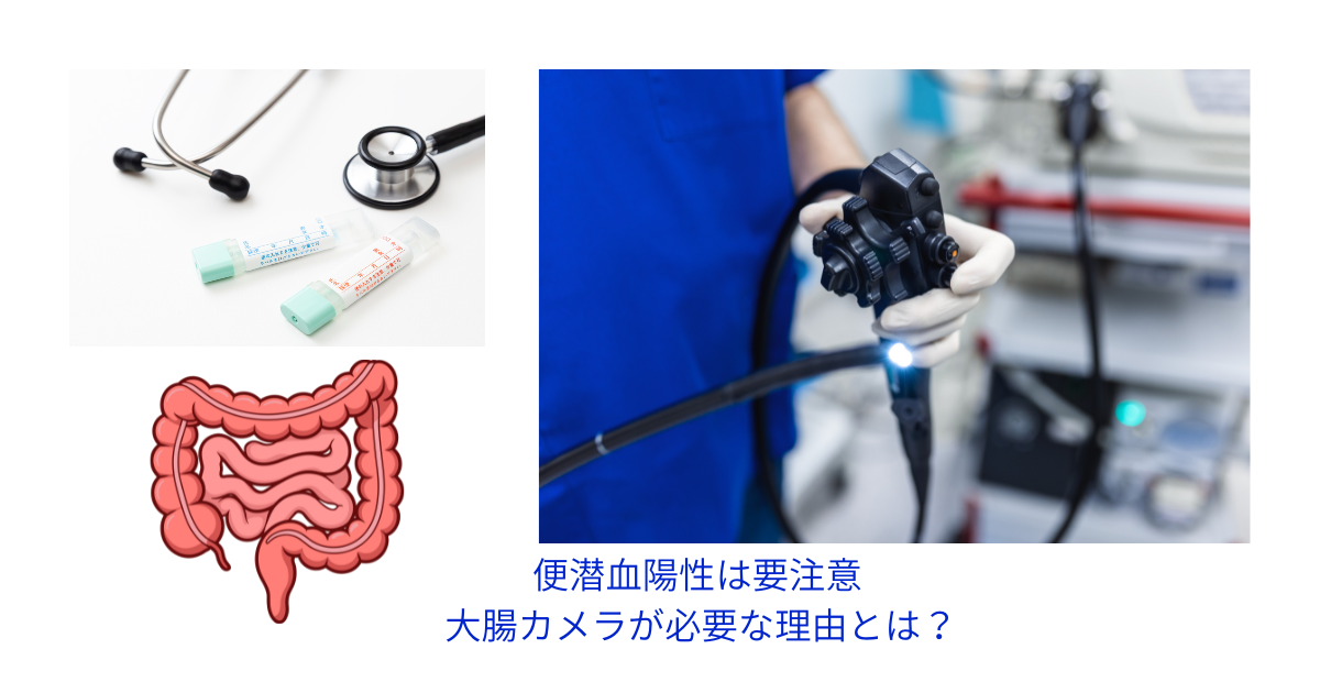 「大腸のイラストと便潜血検査キット、内視鏡を組み合わせた、大腸がん検査の重要性を伝える医療ブログ用アイキャッチ画像」