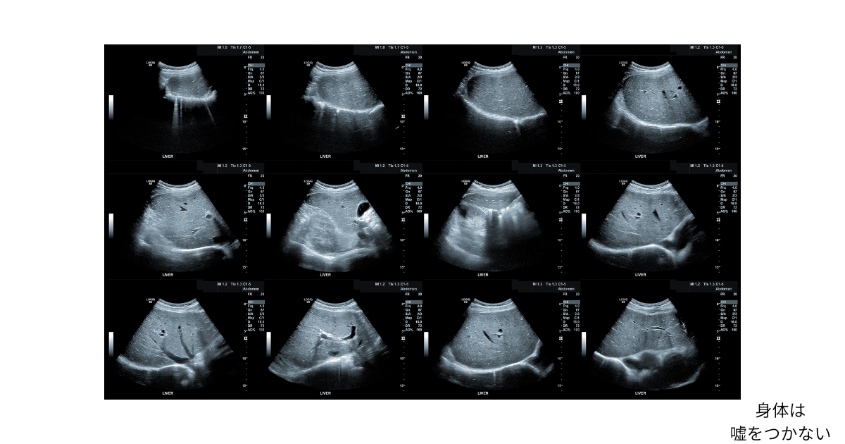 エコー検査で見える身体の変化を通して、頑張りすぎが身体に痕跡として現れることを示唆するイメージ